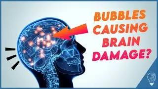 Cavitation bubbles in traumatic brain injury