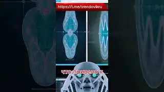 Нейросети диагностируют болезни за секунды! 🏥🤖 #искусственныйинтеллект #нейросети
