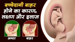 बच्चेदानी खिसकने के ये 5 लक्षण दिखते ही हो जायें सावधान | Bachedani Khisakne Ke Lakshan