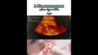 МАЛУМОТ УЧУН ФАКАТ ТЕЛЕГРАМДАН ЁЗИНГ: +998950014004 #Узи #беременность #гинекология #Хомиладорлик