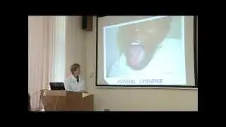 Вирусы - возбудители кровяных инфекций; возбудители ВИЧ-инфекции, вирусы герпеса. О.В. Перьянова