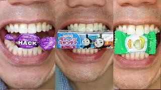 Doctor Tristan Peh Top Viral ASMR Videos Compilation ❤️