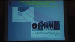 Alexander Oron - Nonlinear dynamics of thin liquid films under external forcing, Part 2