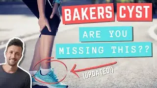 BAKERS CYST Exercises You Should Be Doing (Updated)