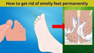 How to get rid of smelly feet permanently