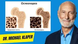 Главная Причина Остеопороза | Доктор Майкл Клапер
