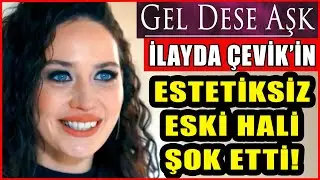 Gel Dese Aşk'ın Bahar'ı İlayda Çevik'in Estetiksiz Hali Görenleri Şok Etti!