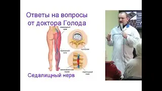 Как лечить седалищный нерв - ответ от доктора Голода