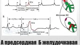 Юрак ритмининг бузилишлари билан булган беморлар курацияси