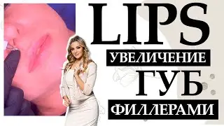 Lips. Увеличение губ Филлерами.