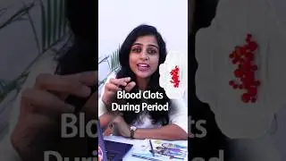 Blood clots during periods are normal & occur when the uterine lining sheds rapidly. 