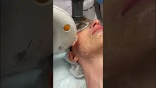 #Фотоомоложение