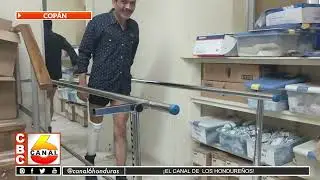 Programa de prótesis y órtesis de fundación CAMO