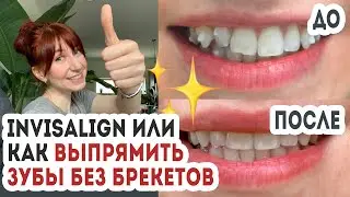 ДО и ПОСЛЕ | элайнеры (капы) Инвизилайн (InvisAlign) | Отзыв, мои результаты и цена
