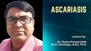 Ascariasis