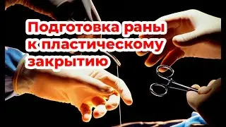 Раневое покрытие Хитокол в комплексе подготовки раны к пластическому закрытию. Цветков В.О.