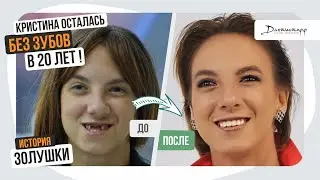 Кристина осталась БЕЗ ЗУБОВ в 20 лет! → Дантистофф 