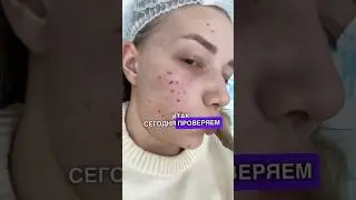 КРОВЬ В ЛИЦО😱🚨
