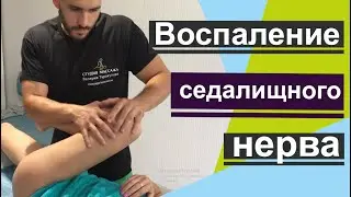Воспаление седалищного нерва, работа с болью в области ягодиц и поясницы