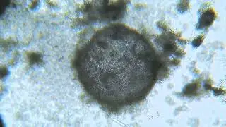 Yoghurt Mold Under Microscope