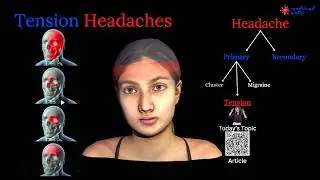 Tension Headache, the most common physical complaint. Causes, how it happens, how to treat it.
