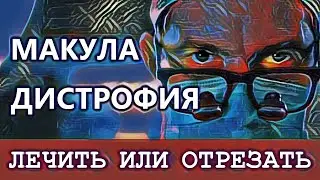 Можно ли восстановить зрение при макулодистрофии