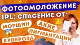 Фотоомоложение  или IPL  терапия – спасение от морщин и не только.