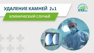 Удаление камней из почки (2 операции в одной) | Медицинский центр 21 век 