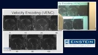 Introducing MRI: Phase Contrast MRA (45 of 56)