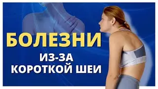 Опасные болезни у людей с короткой шеей. Укороченная шея, холка