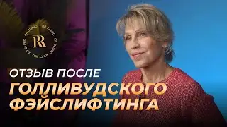 История преображения. Как «Голливудский Фейслифтинг» изменил мою жизнь