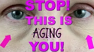 HOW TO FIX UNDER EYE CREASING