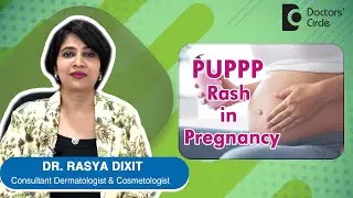 PUPPP Rash in Pregnancy Causes, Symptoms, Prevention & Treatment - Dr. Rasya Dixit | Doctors' Circle