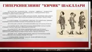 Ревматик хорея