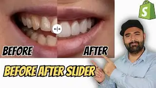 How To Add Before And After Slider To Shopify?