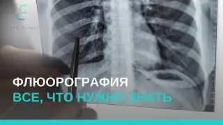 Флюорография — что вам нужно знать?