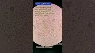 Facts about sperm agglutination 