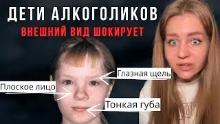 Даже бокал вина может отразится на внешнем виде твоего ребенка😳🤯