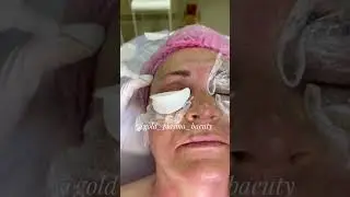 Холодная плазма | Обучение | Аппаратная косметология