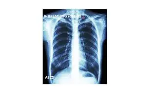 Radiology of Thorax (Chest)