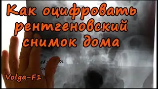 Как оцифровать рентгеновский снимок