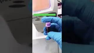 Complete blood count of a pediatric patient