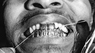 Injury reserve oh shit acapella 150 bpm