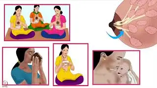 सप्ताह 7 : पांचवा लेक्चर-अ : हाथ से स्तन का दूध निकालना