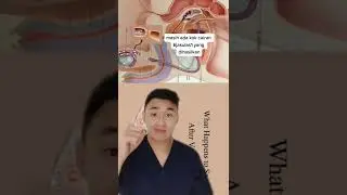 KB pria bikin ga bisa crot ? 