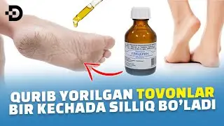 ЁРИЛГАН ТОВОНЛАРНИ БИР БУНДА СИЛЛИҚ ҚИЛИШ УЙ ШАРОИТИДА