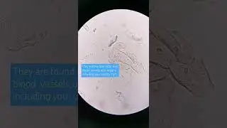 Epithelial cells in urine under the microscope 
