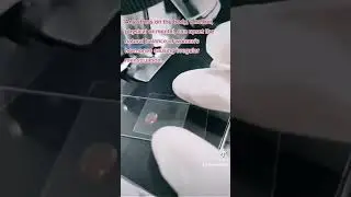 menstrual blood under the microscope 