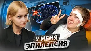 «‎Упала лицом на асфальт, ничего не помню»‎ | Эпилепсия: приступы, лечение