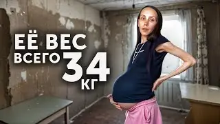 ЕЁ ВЕС ВСЕГО 34 КГ И ОНА РОДИЛА ЧЕТВЕРЫХ...